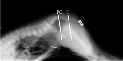 Labeling male anorectal malformations: objective evaluation of radiologic imaging before surgery